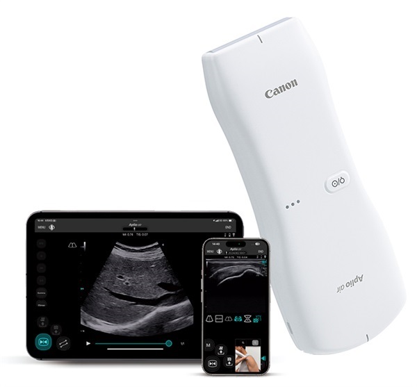 超音波診断装置 Aplio air CUS-AAR00(＋5年保証のみ）